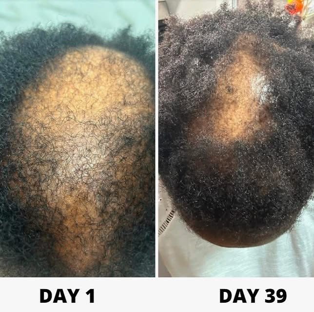 Viral Scalpy Ampoule