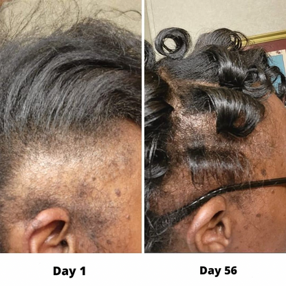 Viral Scalpy Ampoule