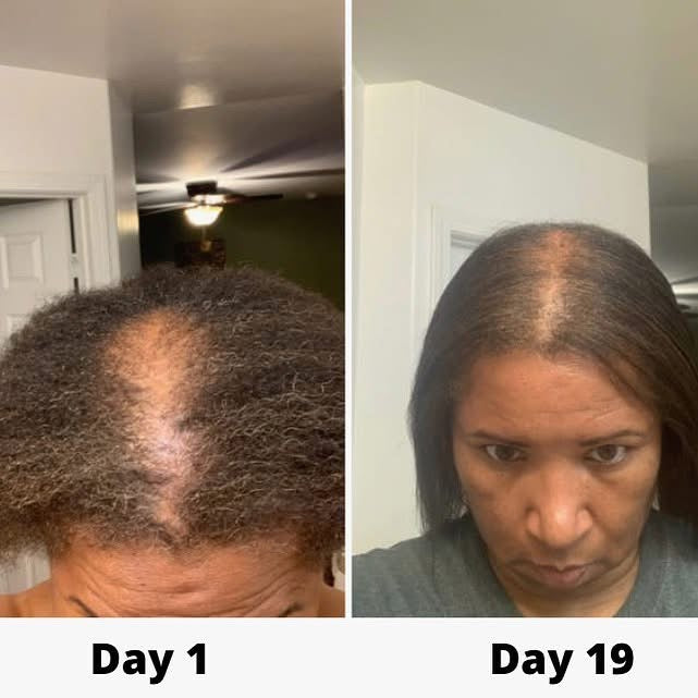 Viral Scalpy Ampoule